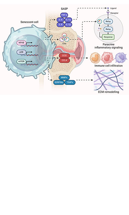 Molecular basis of senescence in osteoarthritis